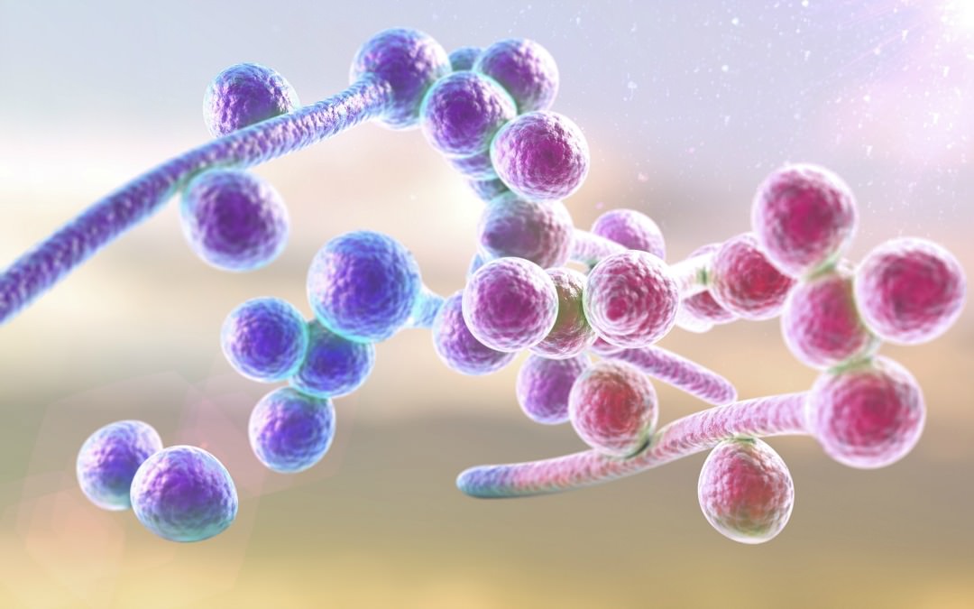 Overcoming Candida with a Detox Program